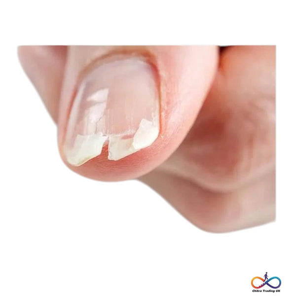 10ml Keratin Vitamin Nail Strengthener - Prevent Chipping & Peeling, Nail Care